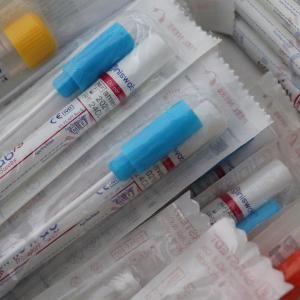 COVID-19 - Tests antigéniques : les modalités de déploiement